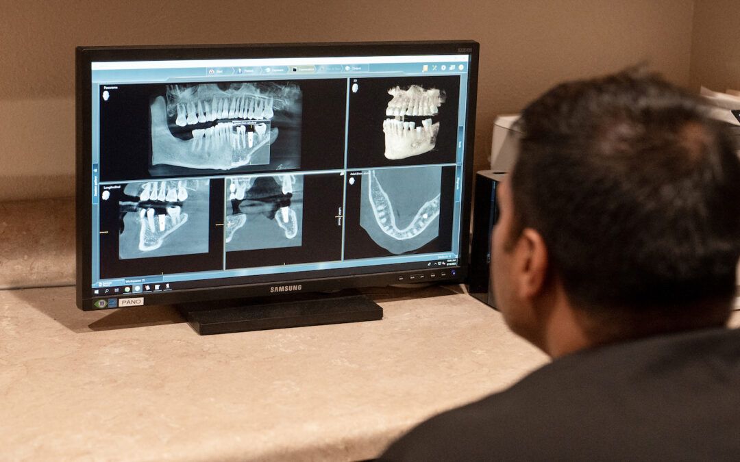 Are Dental Implants Really Worth the Investment? A Guide for Tampa Residents